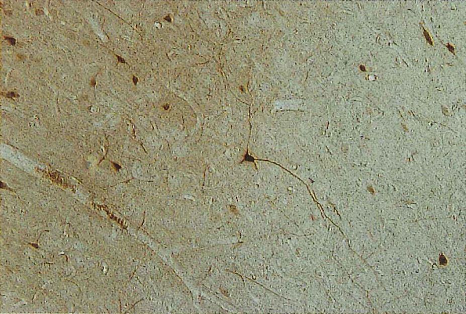 ラット脳皮質のCalbindin D 陽性ニューロン B。0μm切片、200×