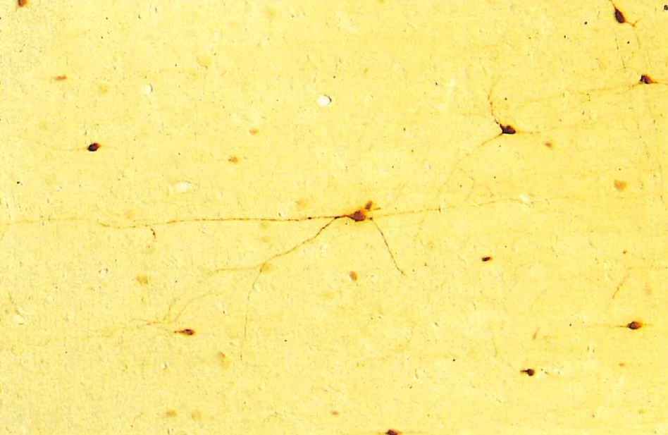 ラット脳皮質のCalbindin D 陽性ニューロン A。30μm切片、200×