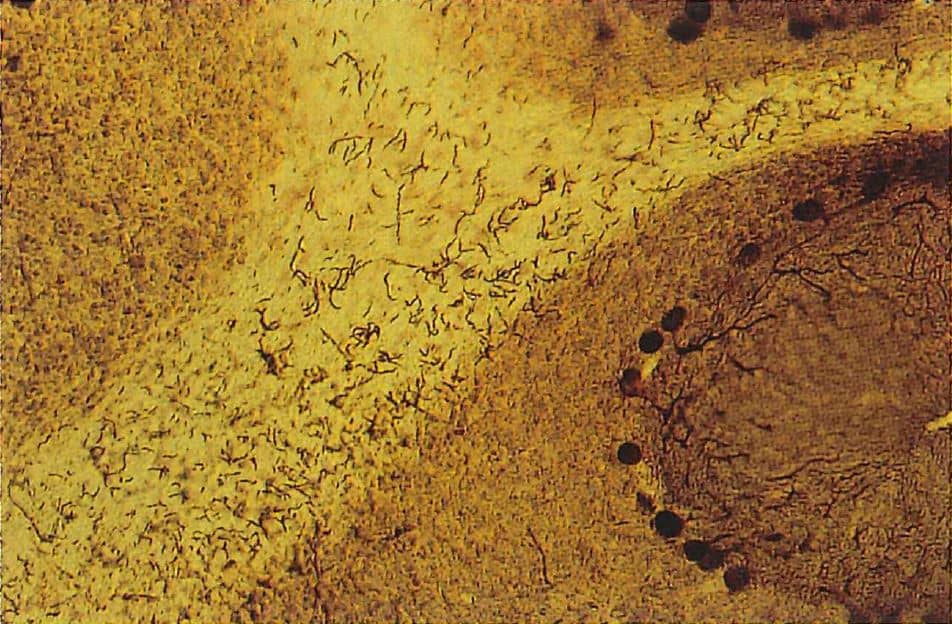 小脳のCalbindin D 陽性のプルキンエ細胞