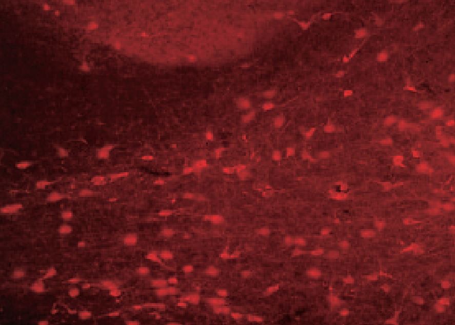 ラット前脳基底のコリン作用性中隔ニューロンをラベリング。コリンアセチルトランスフェラーゼ（ChAT）に対し、多クローン性抗血清を使用