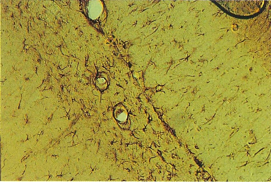 ラット海馬のGFAP陽性の星状膠細胞。星状膠細胞が血管を取り巻いている。30μm切片、200×
